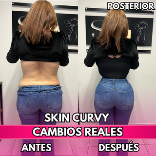 Skin Curvy