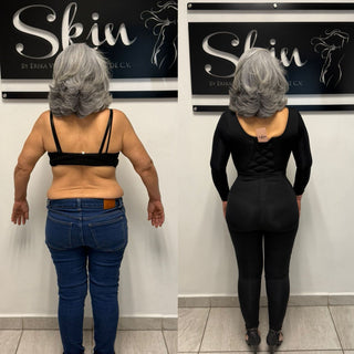 Skin Body Manga Larga