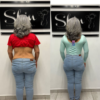 Skin Body Manga Larga