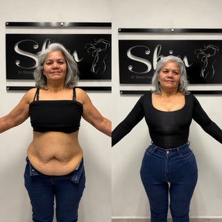 Skin Body Manga Larga