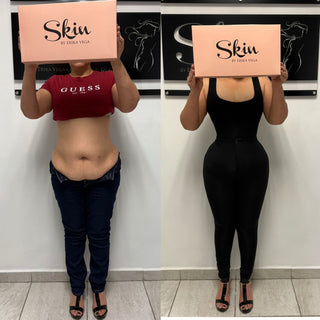 Skin Body Tirantes