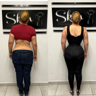 Skin Body Tirantes