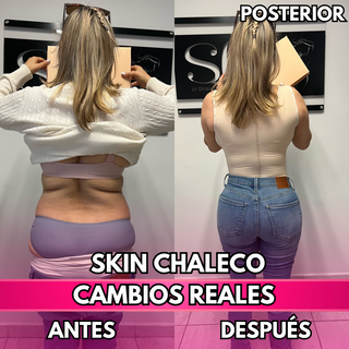 Skin Chaleco