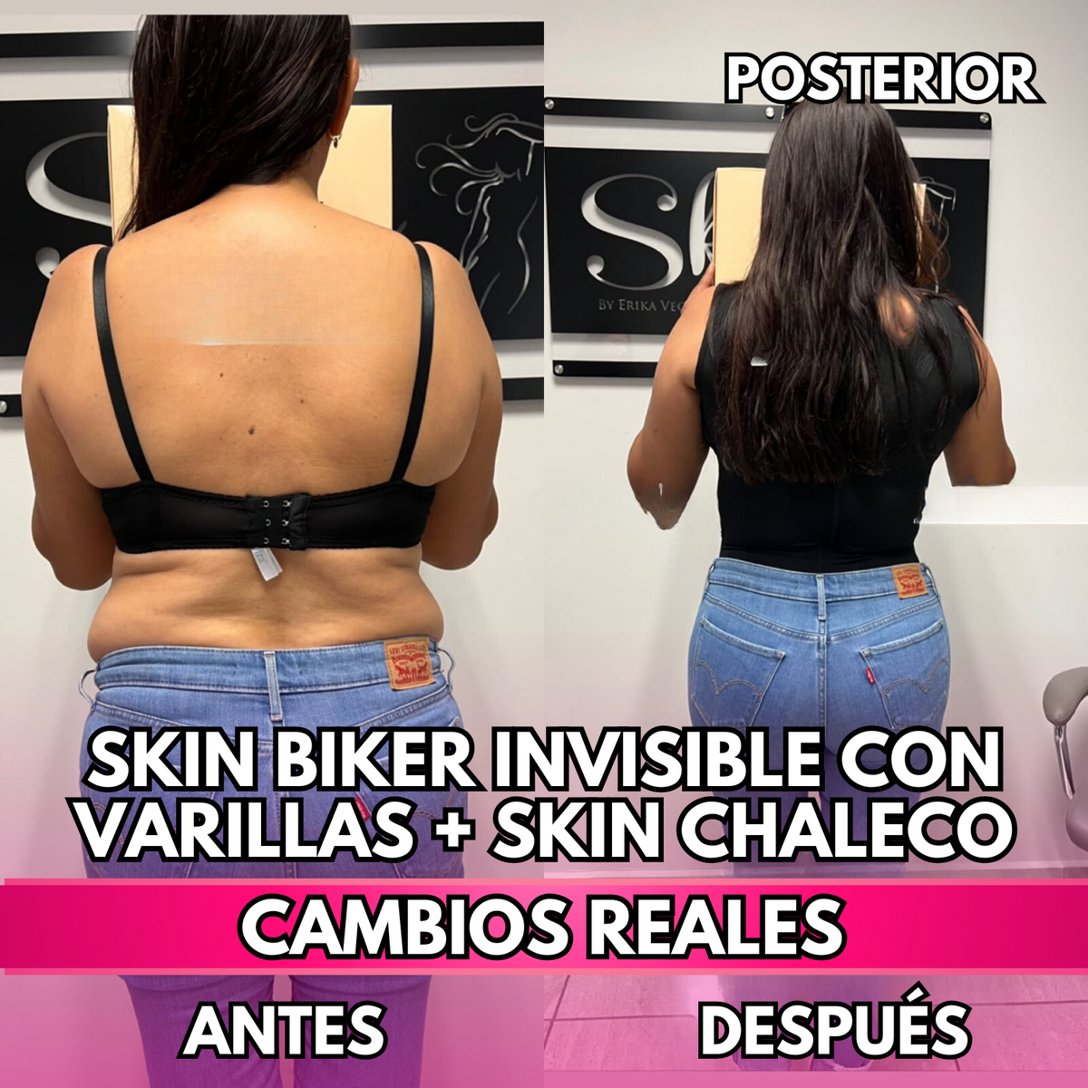 Skin Biker Invisible con Varillas